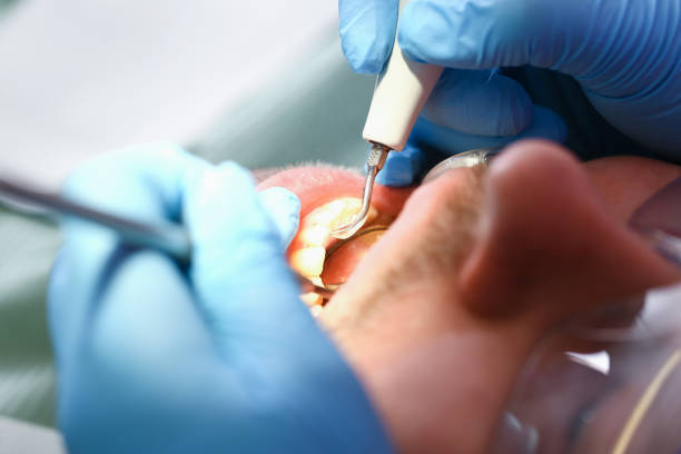 Best Emergency Treatment for Oral Infections in Mcqueeney, TX