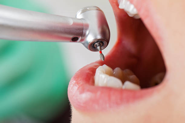 Best Emergency Care for Gum Disease in Mcqueeney, TX